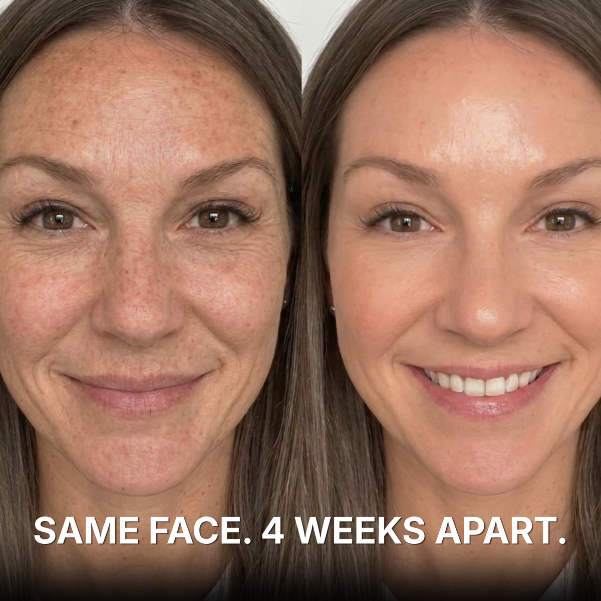 Anti-Wrinkle Balm with PDRN + Collagen