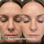 Anti-Wrinkle Balm with PDRN + Collagen