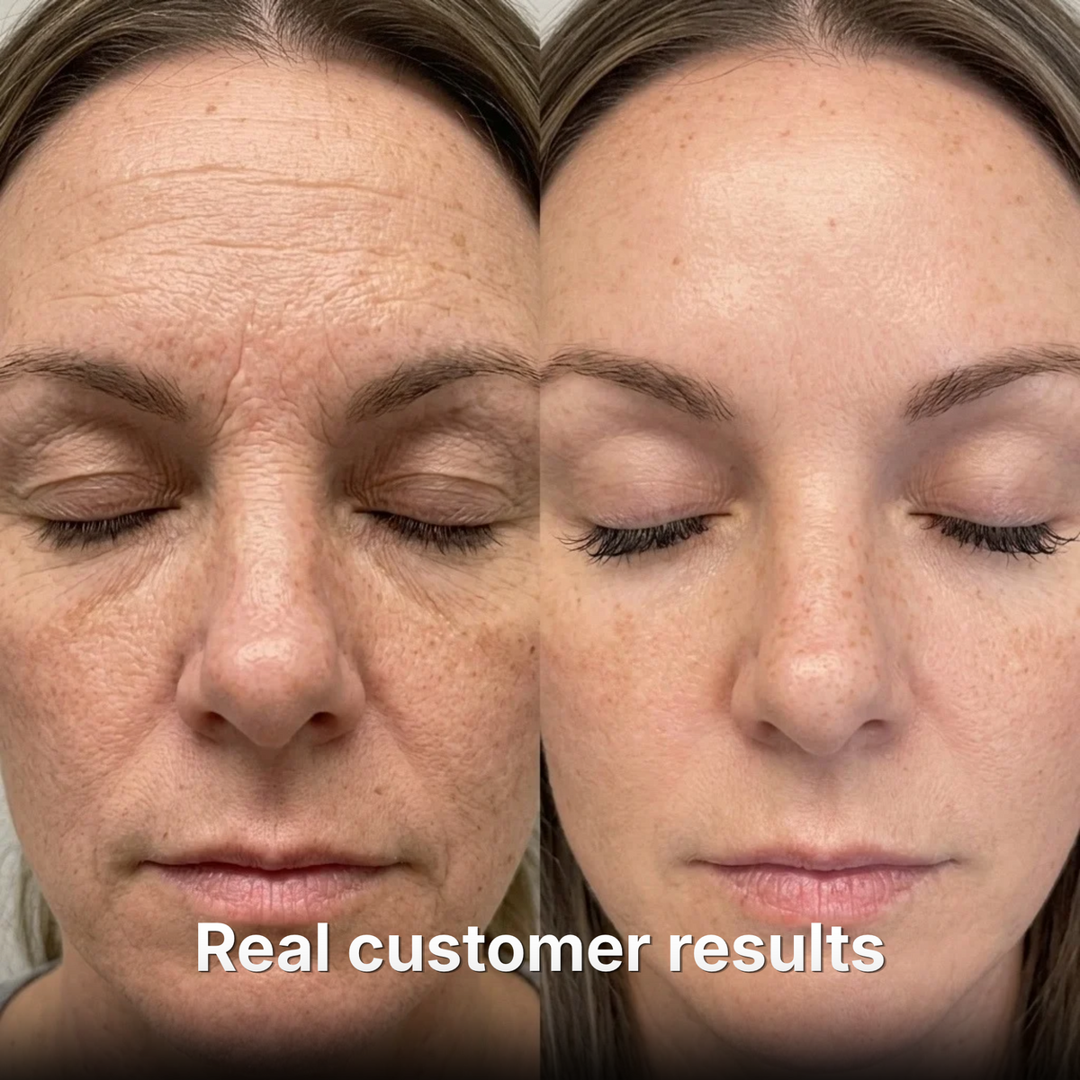 Anti-Wrinkle Balm with PDRN + Collagen