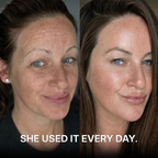 Anti-Wrinkle Balm with PDRN + Collagen
